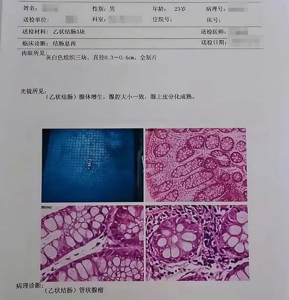 檢測到了腸癌相關基因的突變,考慮有腸道疾病的可能,需要儘快做腸鏡