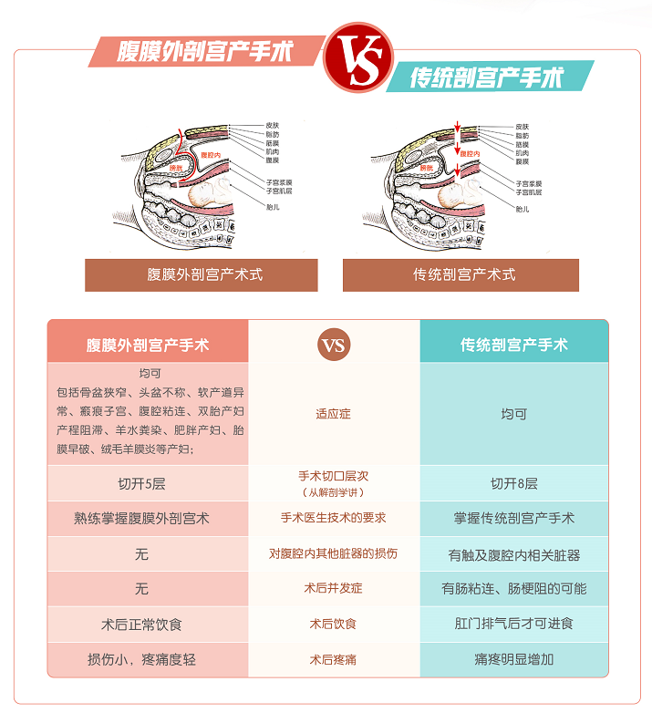 腹膜外剖宮產對醫生的手術技巧要求較高