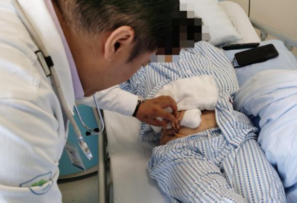 一刀剁下半个手指深圳医生肚子上挖块肉种好新手指