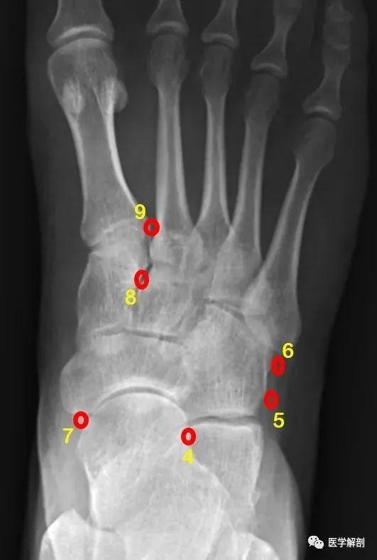 籽骨 sesamoid bone副骨是與相鄰骨分離的繼發性骨化中心.