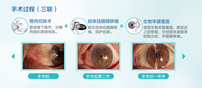 愛爾眼科