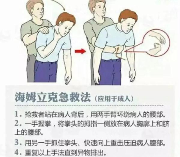 长沙市120急救中心今年以来共受理气道异物梗阻呼救160余起.