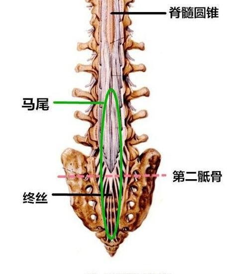 导致马尾神经损伤的病因还有终丝脂肪变性