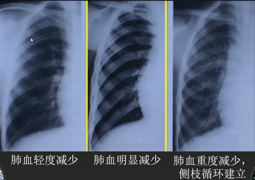 儿科先天性心脏病 消化系统疾病影像诊断难点多 了解这些少踩坑 腾讯新闻