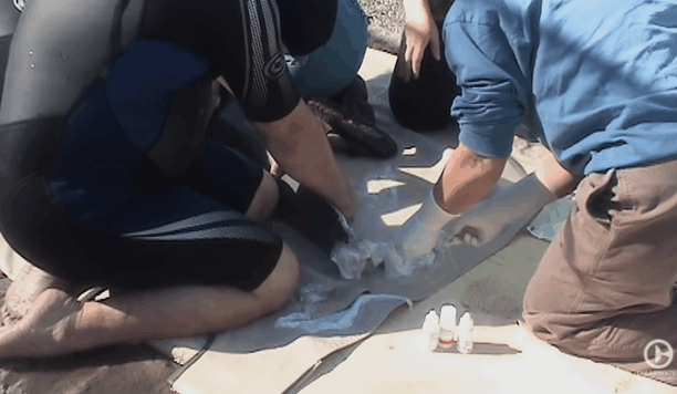 被砍断"双脚"后,她却成了身价20亿巨星,网友:谢谢你,还相信人类