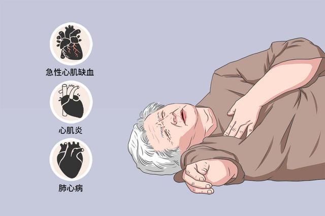 3,其他比如在心律失常,以及在心梗后会出现心脏破裂等异常症状.