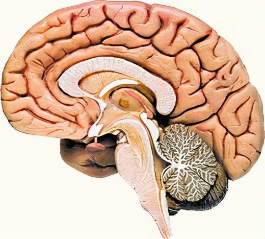 格斯特曼综合征是常染色体显性遗传朊蛋白病由基因突变造成的