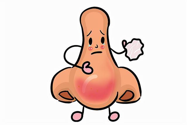 变应性鼻炎的患病率在世界范围内不断上升严重影响患者生活质量