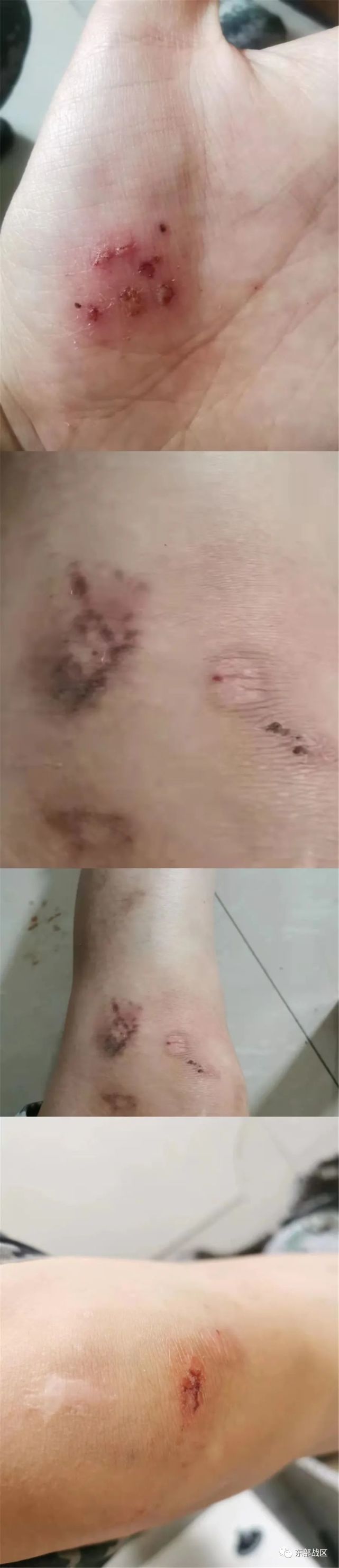 拼!拼!拼!卫生女兵请求出战!