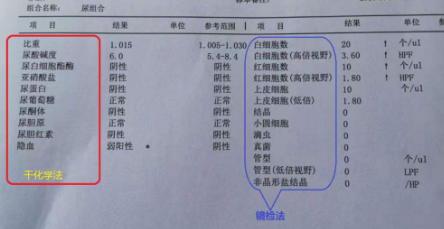 可以將尿常規報告單的解讀分 4 步:第一步:看潛血,尿蛋白,要鑑別是