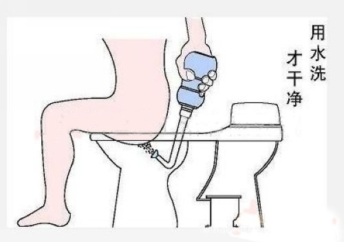 你有清洗肛门的习惯吗能给人带来什么好处不妨了解一下