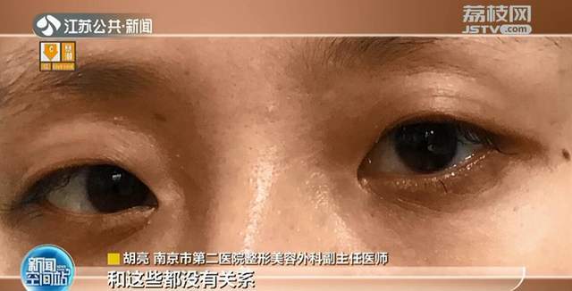 南京一医院开设“黑眼圈”门诊 为“黑眼圈”分门别类-幽兰花香