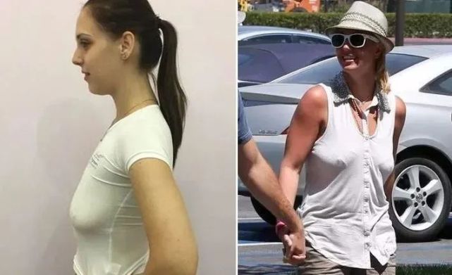 不穿文胸的女性做过一档为期3年的调查发现:但是英国bbc《女性乳房