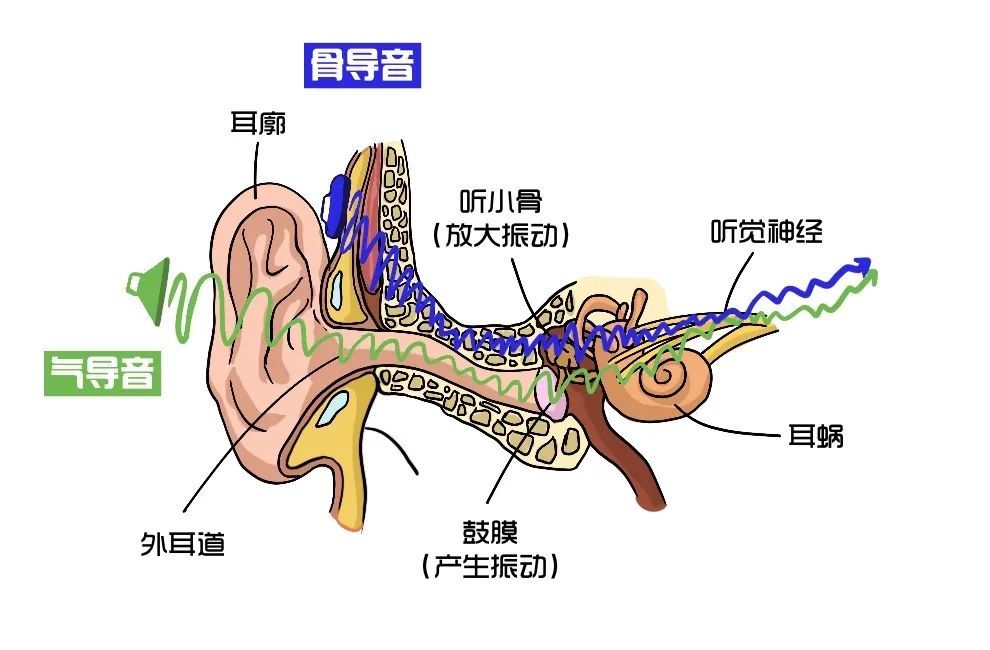 楼层声音传播图图片