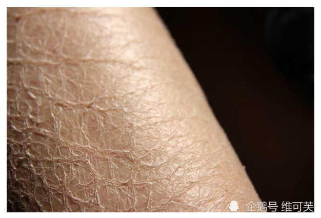 不起眼的小习惯才是导致皮肤干燥的主因