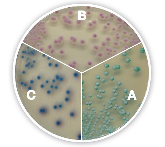 克柔念珠菌(b),热带念珠菌(c)科马嘉培养基上菌落特征种:即真菌培养