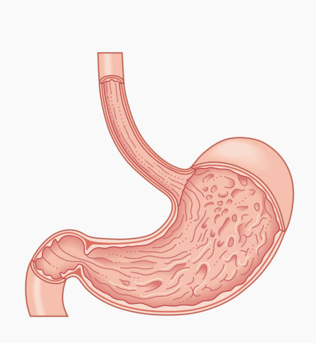 33岁女子狂吐不止只能靠鼻子吃饭竟是胃瘫了
