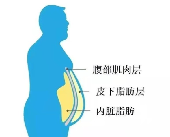 想減掉腹部脂肪時減掉內臟脂肪比減掉皮下脂肪更重要嗎