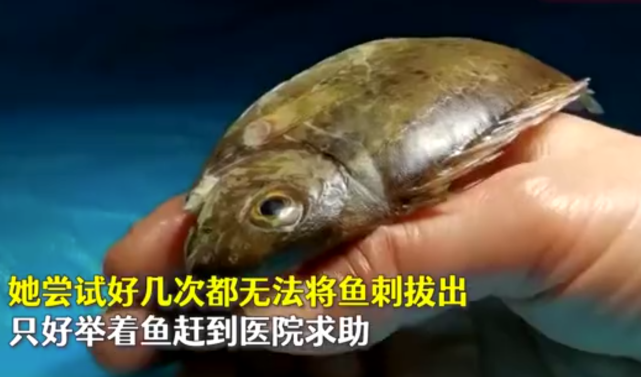 广西女子手举生鱼闯进急诊室求助医生她做得对
