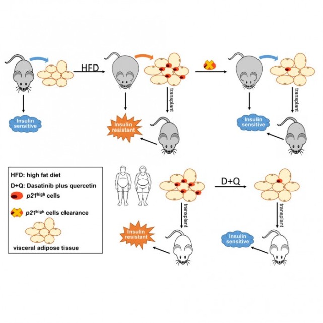 研究称实验性药物可清除僵尸细胞或有助于缓解糖尿病