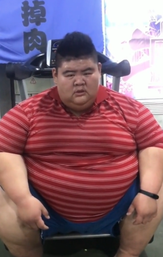 山东第一胖为爱减重400斤,如今瘦出锁骨,网友直呼认不出