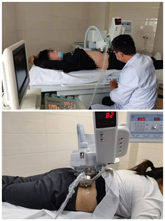 普外泌外科引进冲击波体外碎石机