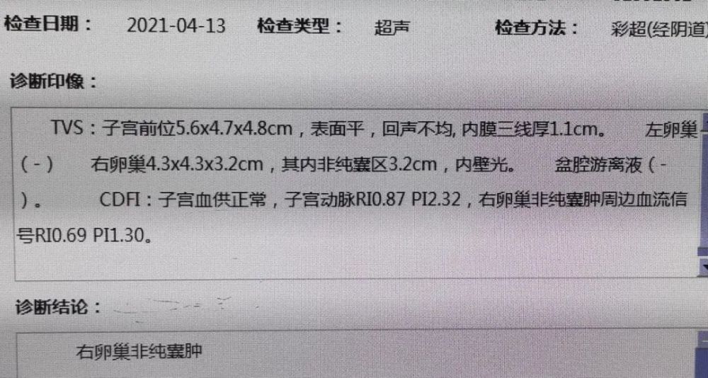 案例分析頻繁痛經不規則出血子宮內膜異位症在作怪