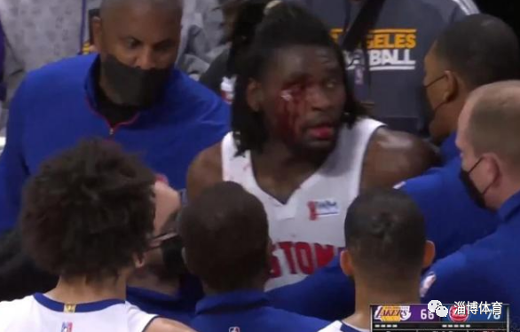 nba 詹姆斯肘击被驱逐，这都不算什么，真正的肘击之王你猜不到是谁