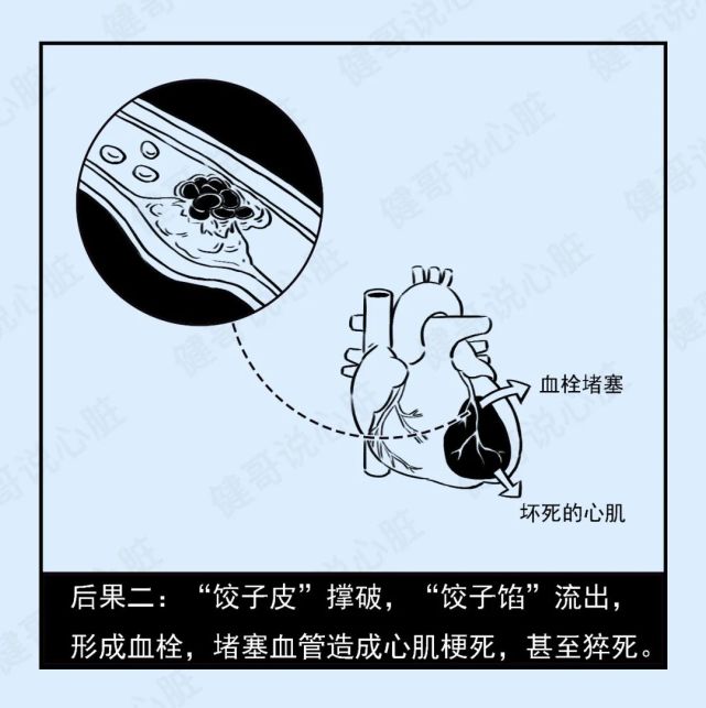 心臟健康知識就在《健哥說心臟》· ·· ·專家介紹劉健 教授北京