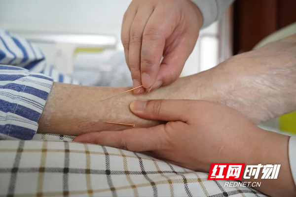 健康知识丨腕踝针 为患者按下"止痛键"