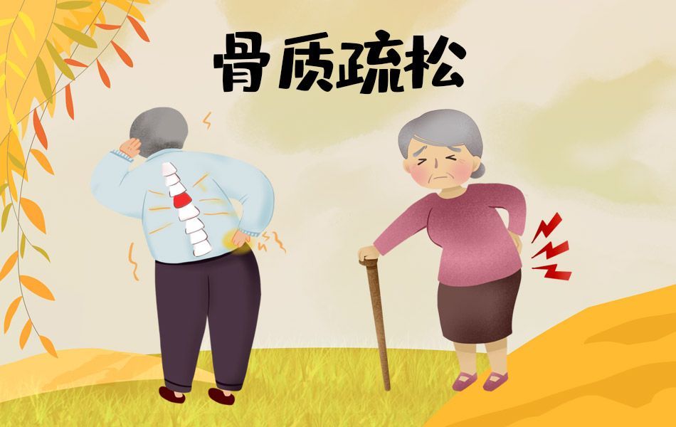 老年人骨质疏松怎么预防3种食物最有效