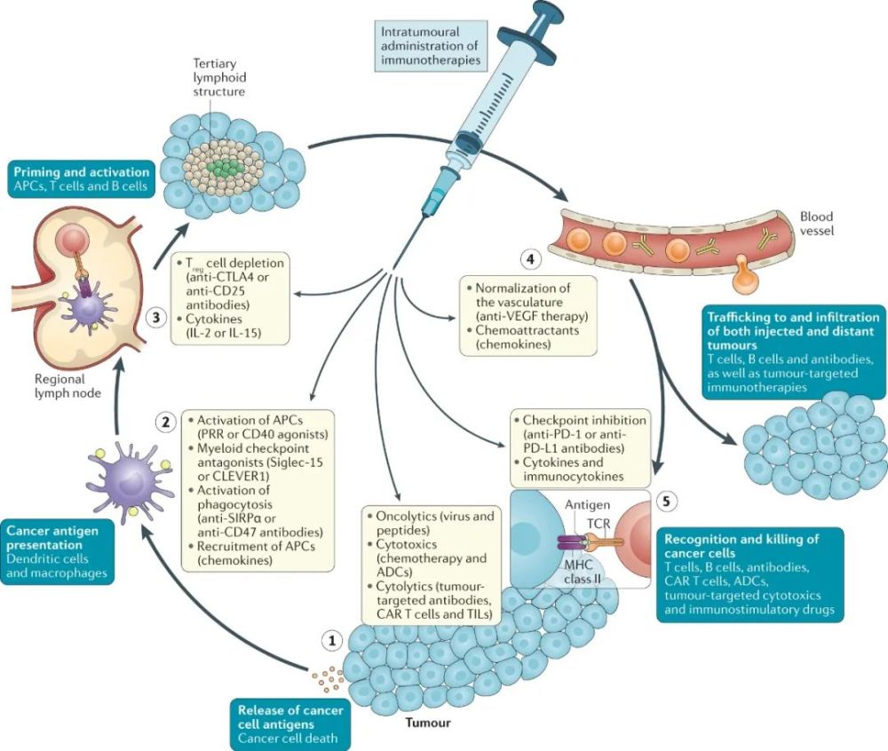 natrev肿瘤内给药和肿瘤组织靶向的免疫疗法