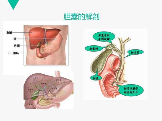 有胆囊疾病一定要切除胆囊胆结石息肉会癌变吗医生告诉你