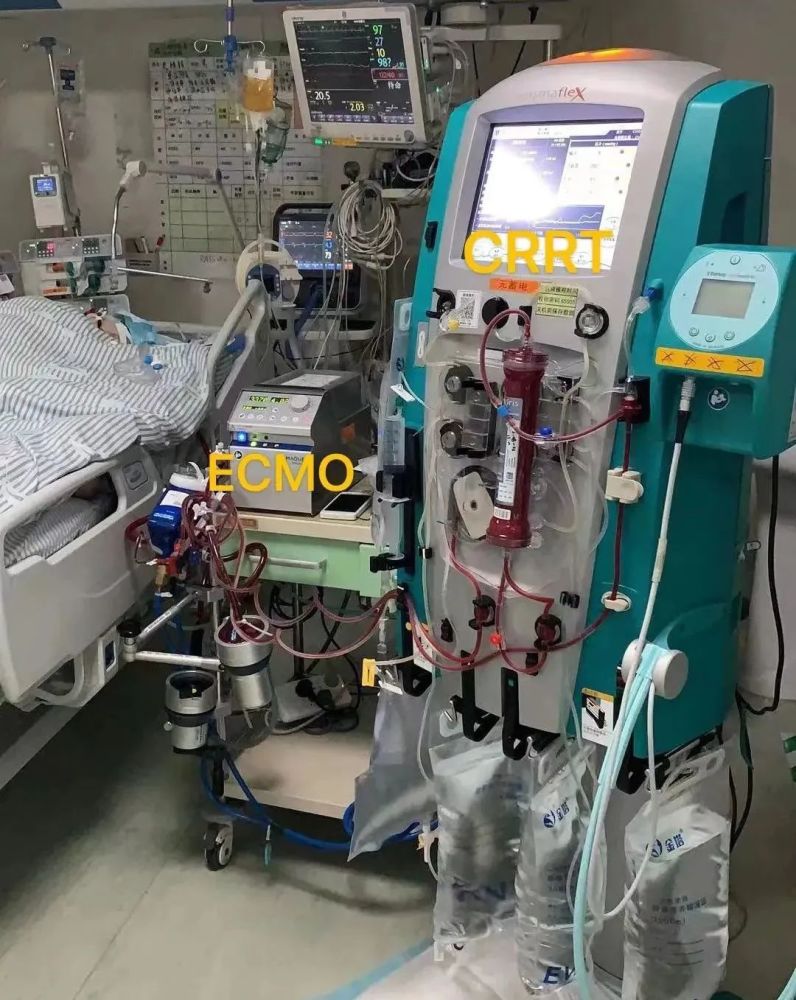 icu里,与死神赛跑的19天_腾讯新闻