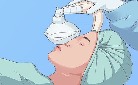 全身麻醉,是指麻醉药物经由呼吸道吸入,静脉注射等方法进入体内,从而