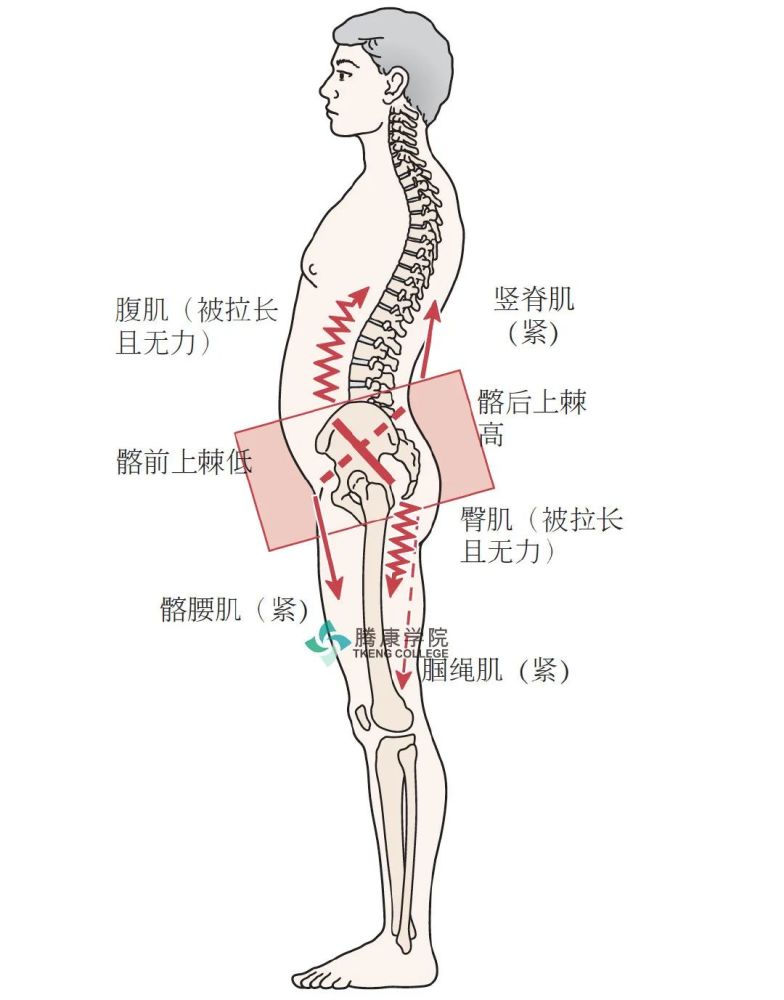 髂腰肌髂腰肌是一条又大又长的肌肉,连接了躯干和下肢,是人体中直接从