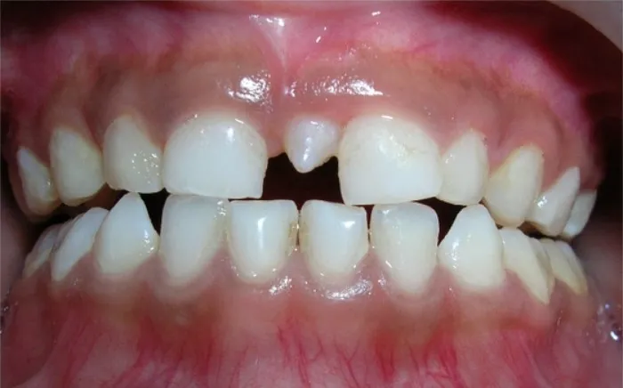 比悲伤更悲伤的事情牙缝大不仅丑还可能是病