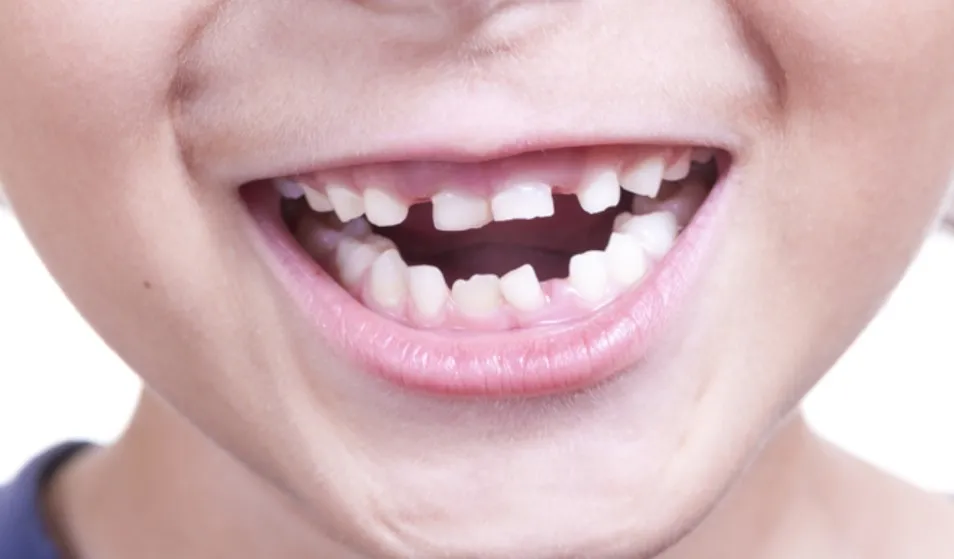 比悲伤更悲伤的事情牙缝大不仅丑还可能是病