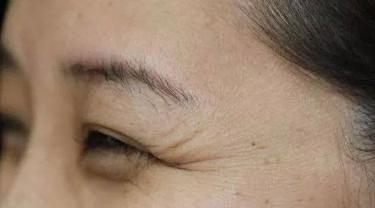 相信笑一笑十年少的你现在还笑得出来吗你是否吃过眼纹的亏