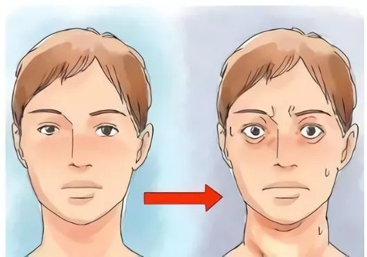 甲亢突眼的症状有哪些?该如何预防?_腾讯新闻