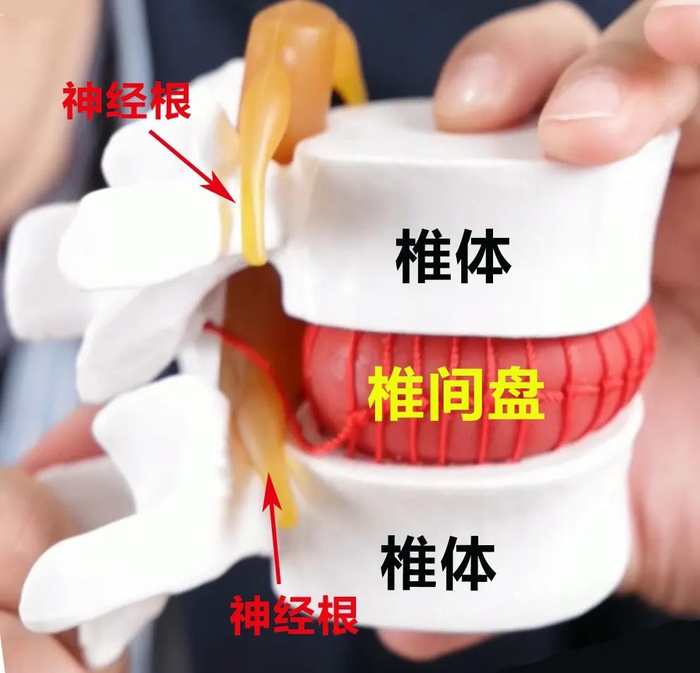 你知道吗腰椎间盘为什么总是向后方突出