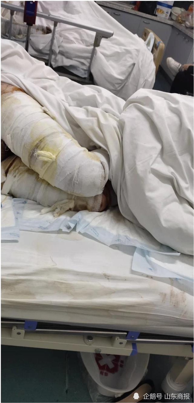 云南女子被丈夫泼汽油烧伤后死亡儿子如果法律允许的话我想拿刀把他砍