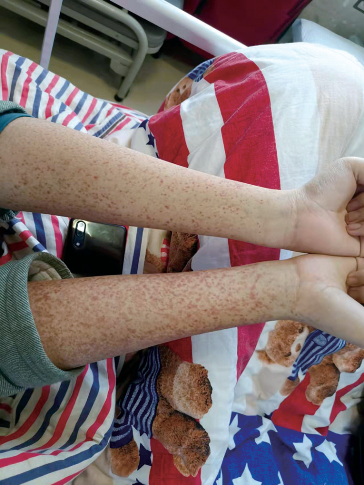 仁济健康丨天啊娃娃皮肤长紫斑到底咋回事