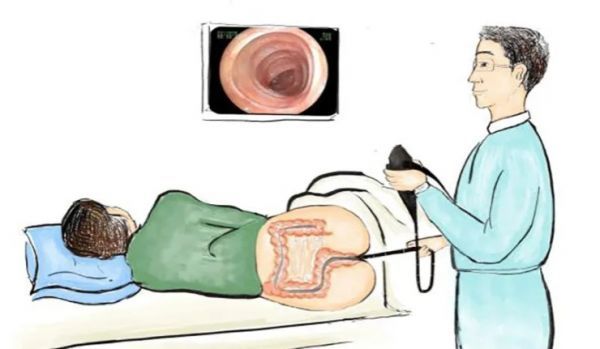 健康科普肠镜检查你应该关注点啥