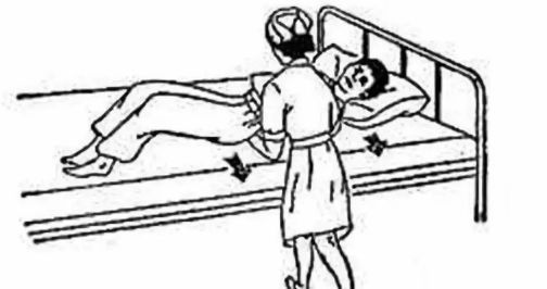 褥疮护理褥疮患者翻身技巧