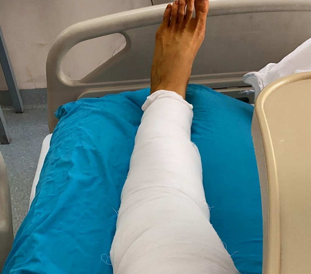 做膝部手术向球迷报平安,病床放不下腿_腾讯新闻