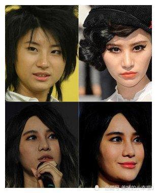 这些年削骨的女明星脸还好吗?后遗症一大堆,有些都开始崩了