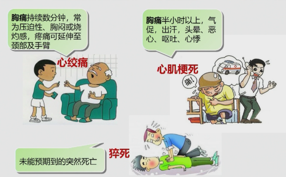 心力衰竭心律失常猝死心肌梗死心绞痛冠心病的类型肥胖或超重吸烟缺乏