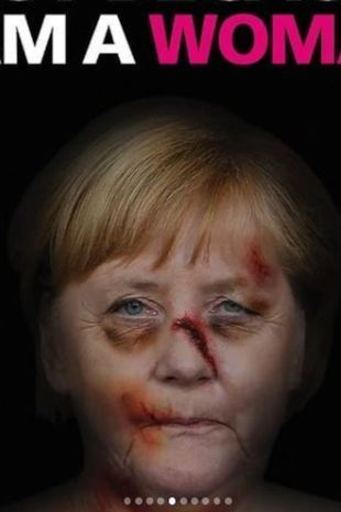 欧洲街头竟出现凯特王妃被打得"鼻青脸肿"的照片,真相让人无语