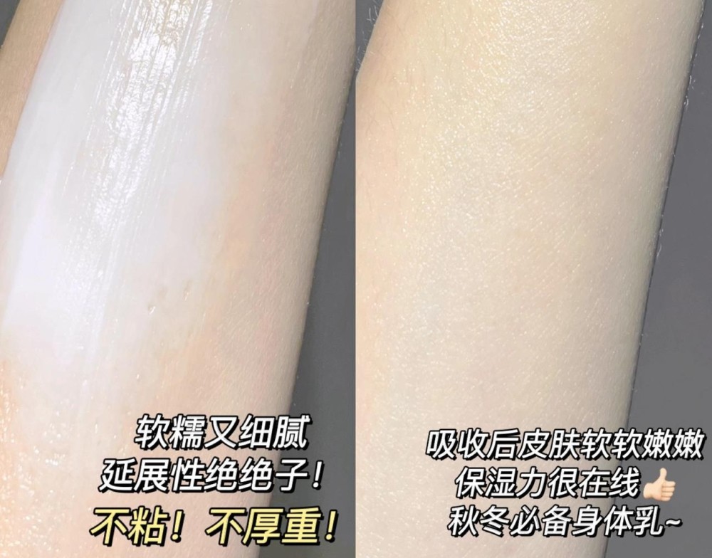 明星推荐身体乳美白去鸡皮(什么牌子的身体乳去鸡皮效果好)